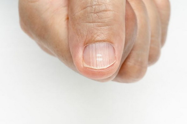 nails-2-LN.jpg 600x400