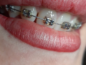prosh-1-LN 600x580