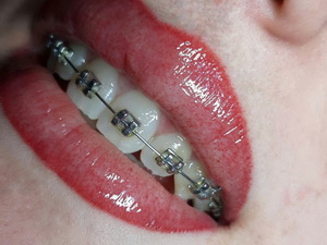 prosh-LN 600x580